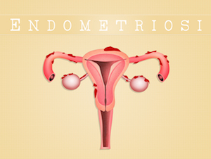 endometriosi-frauenamanteltee endometriosi-frauenamanteltee